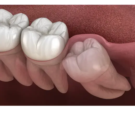 Emergency Dentistry
