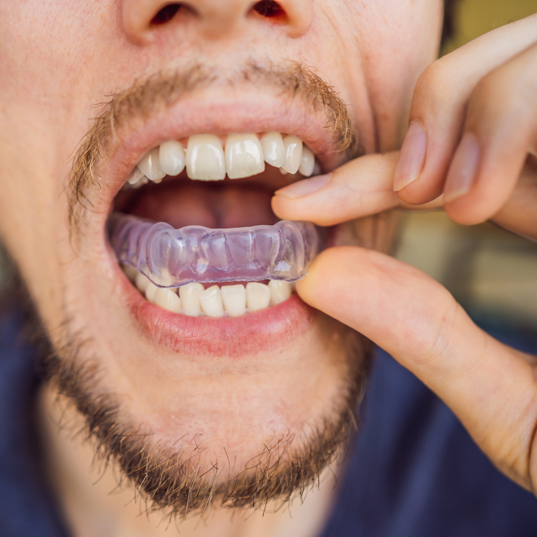 Dental exam to evaluate teeth grinding and fit a custom nightguard at Valley Dental Turlock